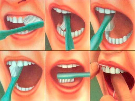 Diş Fırçalama Teknikleri