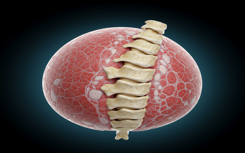 Dişte kemik erimesi neden olur ve nasıl önlenir?